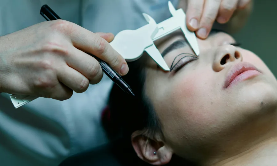 Featured image for Scarring After Eyelid Surgery: What to Expect and Minimize It