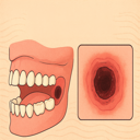 Featured image for Dry Socket After Wisdom Teeth Removal: Symptoms and Prevention
