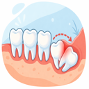 Featured image for Do Wisdom Teeth Cause Crooked Teeth?