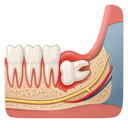 Featured image for Horizontal Wisdom Teeth: What It Means and Treatment Options